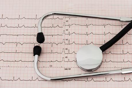 Non-invasive tests may miss heart failure in atrial fibrillation patients: study